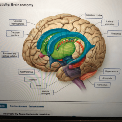 Drag respective appropriate labels targets their labeling activity figure part answers ventricle lateral aperture foramen interventricular third 4b fourth median